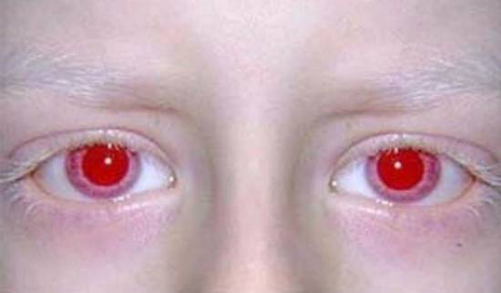 Красные глаза